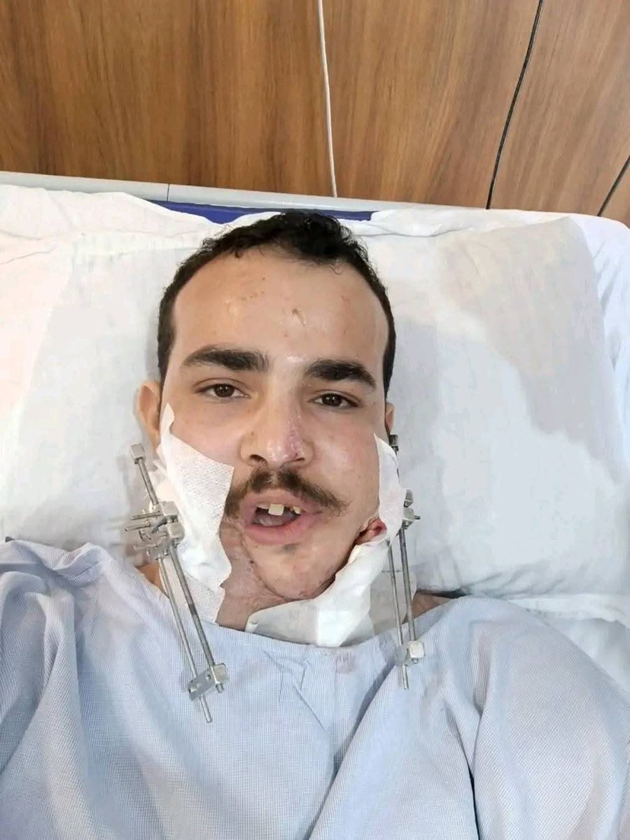 #القيادي الارهابي التابع للميليشيات الحوثية علي الحمزي وهو المسئول عن علاج الجرحى يتسبب في طلاق زوجة هذا الجريح ويتزوجها.
#بحرية_المقاومة_الوطنية
#كذبة_التصنيع_الحربي_الحوثي