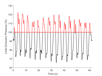 _LukeHughes_'s tweet image. Our new paper investigating tourniquet cuff pressure regulation during #BFR exercise is now online in @FrontSportsAL
We conducted the most in-depth analysis of tourniquet cuff pressure regulation during BFR exercise to date, across several commercially available devices.
Key…