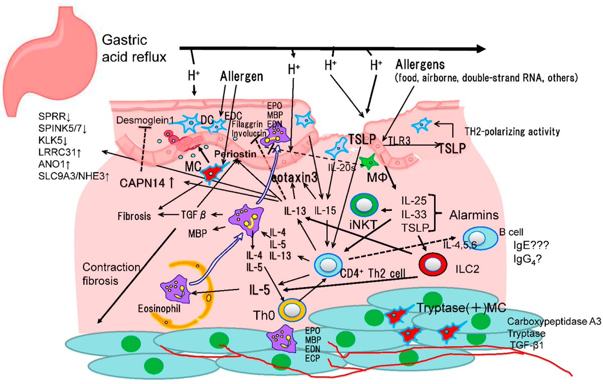 Biomol_MDPI's tweet image. #HighlyAccessedPaper
"Review of Non-Eosinophilic Esophagitis-Eosinophilic Gastrointestinal Disease (Non-EoE-EGID) and a Case Series of Twenty-Eight Affected Patients" by Yoshikazu Kinoshita and Tsuyoshi Sanuki.
Cited 6 times | Viewed 2877 times.
➡️ brnw.ch/21wUqp8
