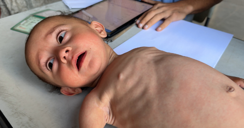 UN's tweet photo. These are the faces of desperate children in Gaza as deadly malnutrition reaches catastrophic levels.

Amid the horrific hunger crisis, the need for humanitarian aid, at scale, has never been greater.

Safe, unrestricted access into Gaza must be urgently granted.

via @UNRWA