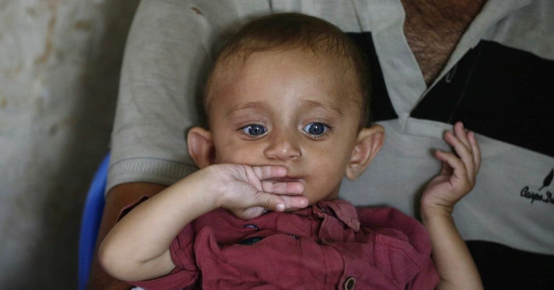 UN's tweet photo. These are the faces of desperate children in Gaza as deadly malnutrition reaches catastrophic levels.

Amid the horrific hunger crisis, the need for humanitarian aid, at scale, has never been greater.

Safe, unrestricted access into Gaza must be urgently granted.

via @UNRWA
