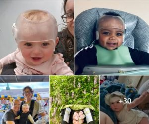 Union Orthotics & Prosthetics Co. tweet media