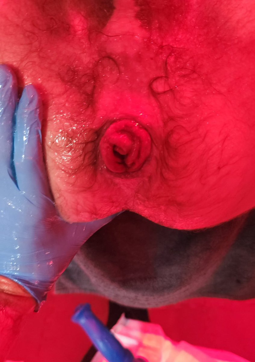 It’s Friday! can anyone please punch my hole into this weekend? 

DMs open 🕳️ 

#fist #ff #gayfist #PIGGS