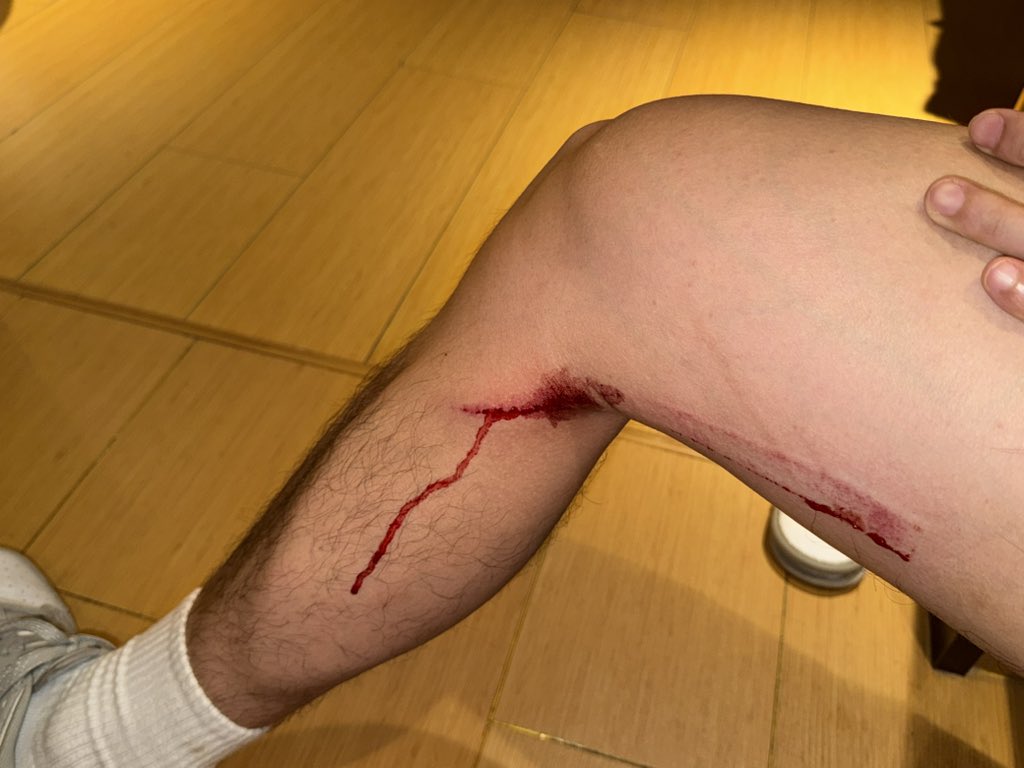 Allen不是狒狒 tweet media