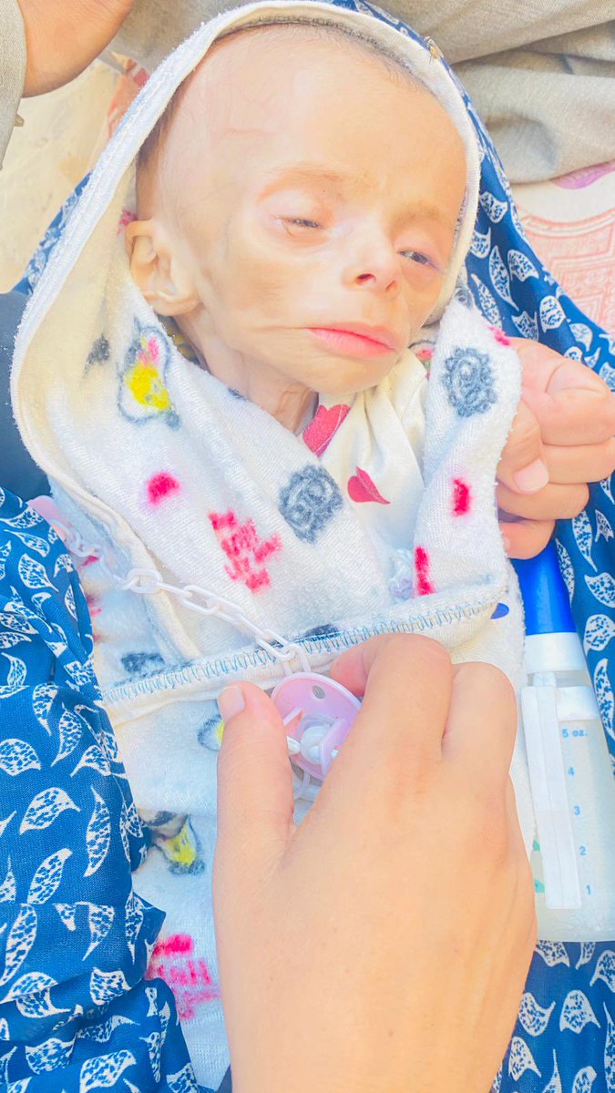 🚨 Zainab Ahmed Muhammad Abu Hlaib, starved to death under the U.S.-Israeli siege, was brought lifeless to Nasser Hospital an hour ago.

Gaza hospitals recorded 9 new deaths from starvation in the past 24 hours, bringing the total to 122, including over 80 children.