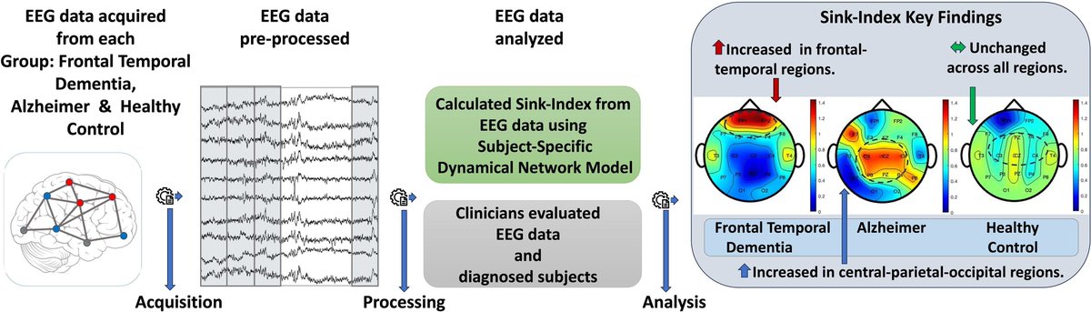 braincomms's tweet image. Sanchez et al. report that the novel Sink-Index, an EEG marker derived from dynamic network models, distinguishes Alzheimer’s disease and Frontotemporal Dementia from Healthy Controls with high accuracy. Read at buff.ly/juLy0fz