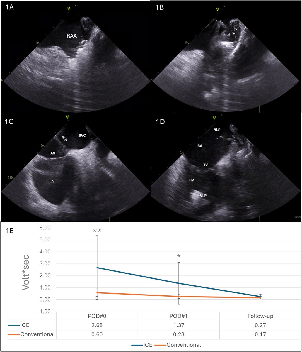 hrs_journal's tweet image. Early Experience with Intracardiac Echocardiogram Guidance for Atrial Leadless Pacemaker Implantation
#OpenAccess
heartrhythmjournal.com/article/S1547-…