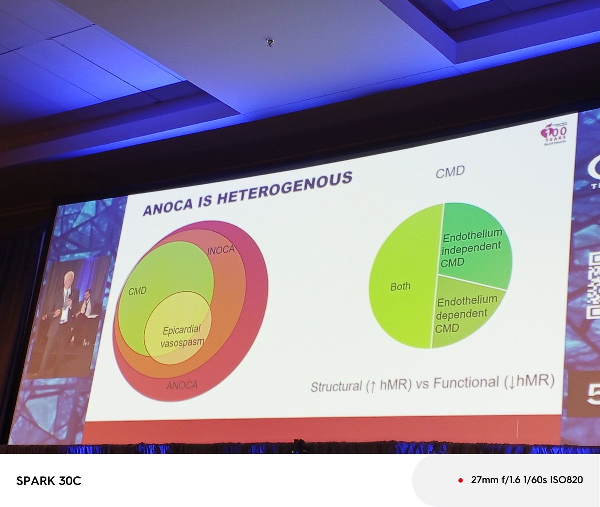 ZainabDakhil2's tweet image. Other amazing slides by @HenrytTimothy on #INOCA #CMD @cvinnovations #CVI2025 @arnoldseto @chadialraies @esbrilakis @shishem @psorajja @timir_paul @mirvatalasnag @Pooh_Velagapudi @mmamas1973 @DrMarthaGulati @InocaInternati1