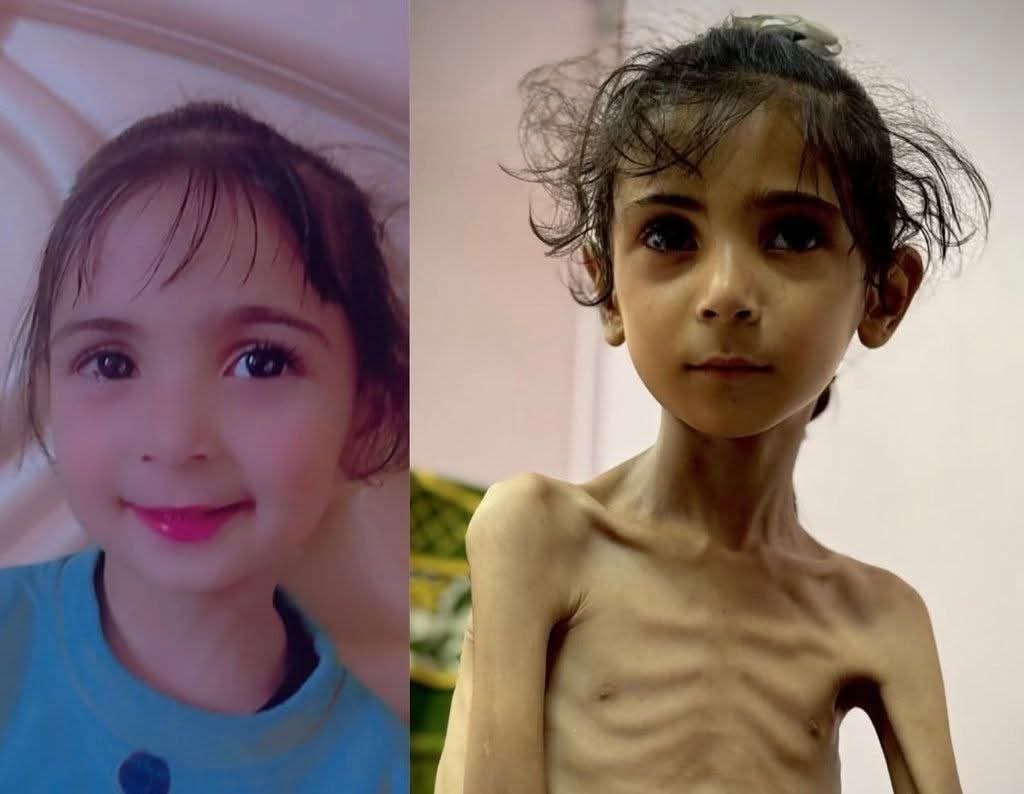 Chief_Walaa's tweet image. Appeal for help ✋🏽💔✋🏽
I don't know what to say, but the agony of getting food and water became very tiring, Support my family.
Our children are dying of hunger💔😥😥😭
If you see this, PLEASE just comment with a dot .
gofund.me/e713f89f