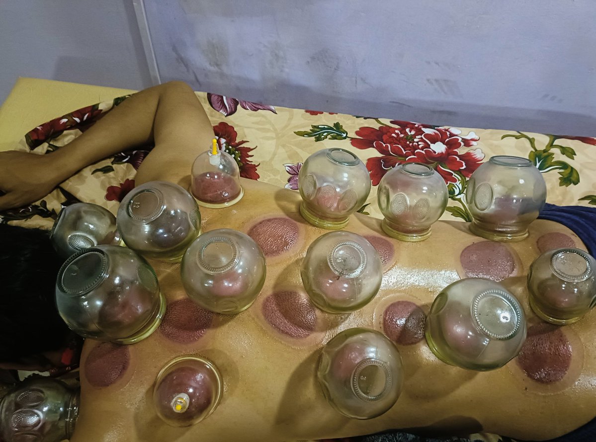 dryeye_dry2's tweet image. यस्तो थेरापी गरियो ।
हुन त जती जे गरेनी आज सम्म निको भएको त होइन । 😢