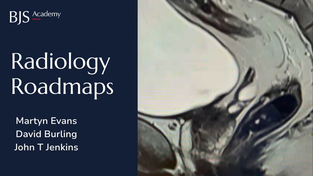 🔍Radiology roadmaps

In conversation with Martyn Evans, David N Burling and John T Jenkins explore radiology roadmaps and provide further insight.

🎥 Watch the video or 🎧 listen to the podcast here: 
➡️bjsacademy.com/bjs-academy/co…

#ColorectalSurgery #Radiology #CancerCare