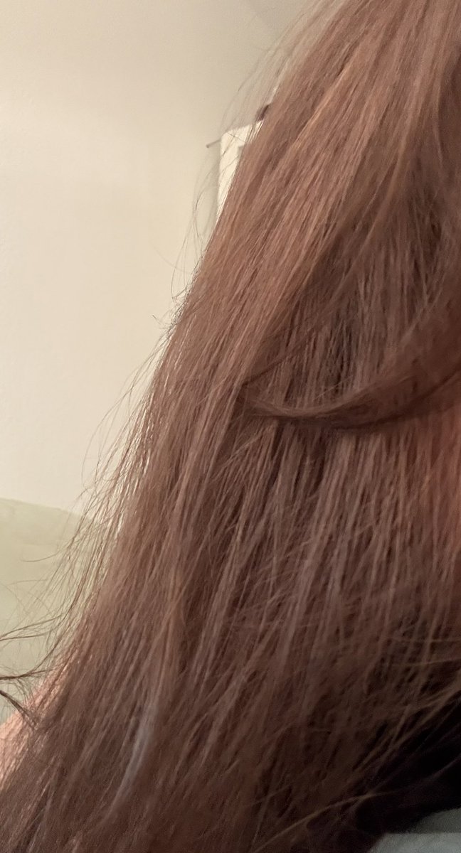 ameszns's tweet image. okay so here is the before and after
well rn they r straight but usually they are not