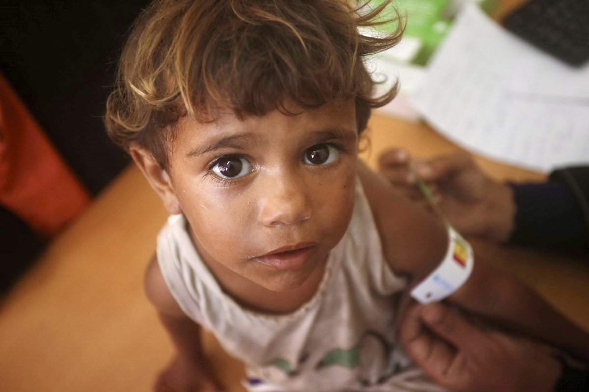 La crise alimentaire s’aggrave à Gaza.

La malnutrition infantile y a atteint un seuil critique.

L’aide humanitaire d’urgence à grande échelle est nécessaire.

Un accès sûr et sans restriction dans l’enclave doit être autorisé pour sauver des vies.