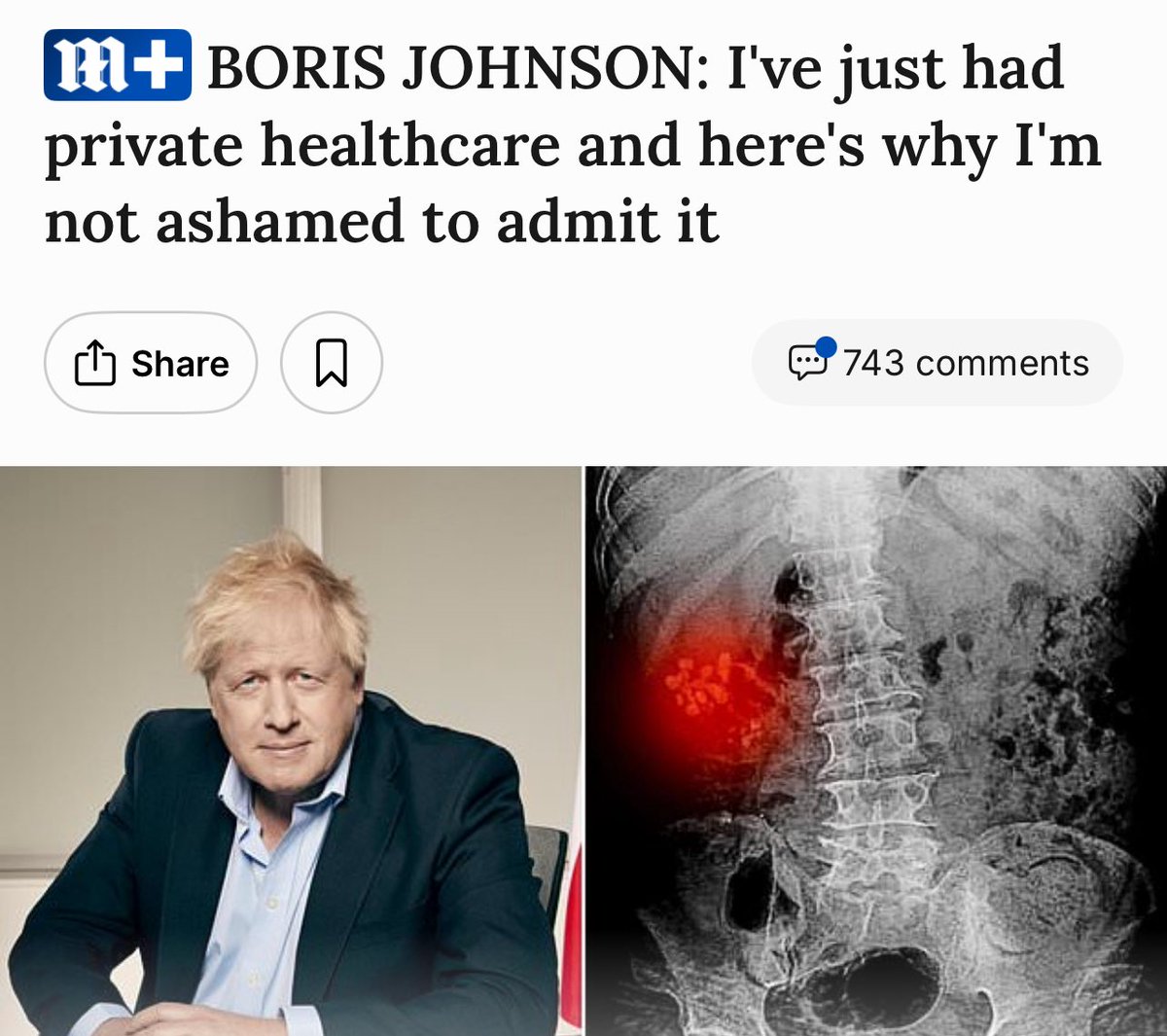 Cutting the NHS until it no longer functions

Move care to private providers to ‘save’ the NHS

Claim the NHS is broken 

Cut pay for Doctors &amp; Nurses in the NHS 

Offer jobs in the private sector without the cost of training

Sell shares in private companies, the rich get richer