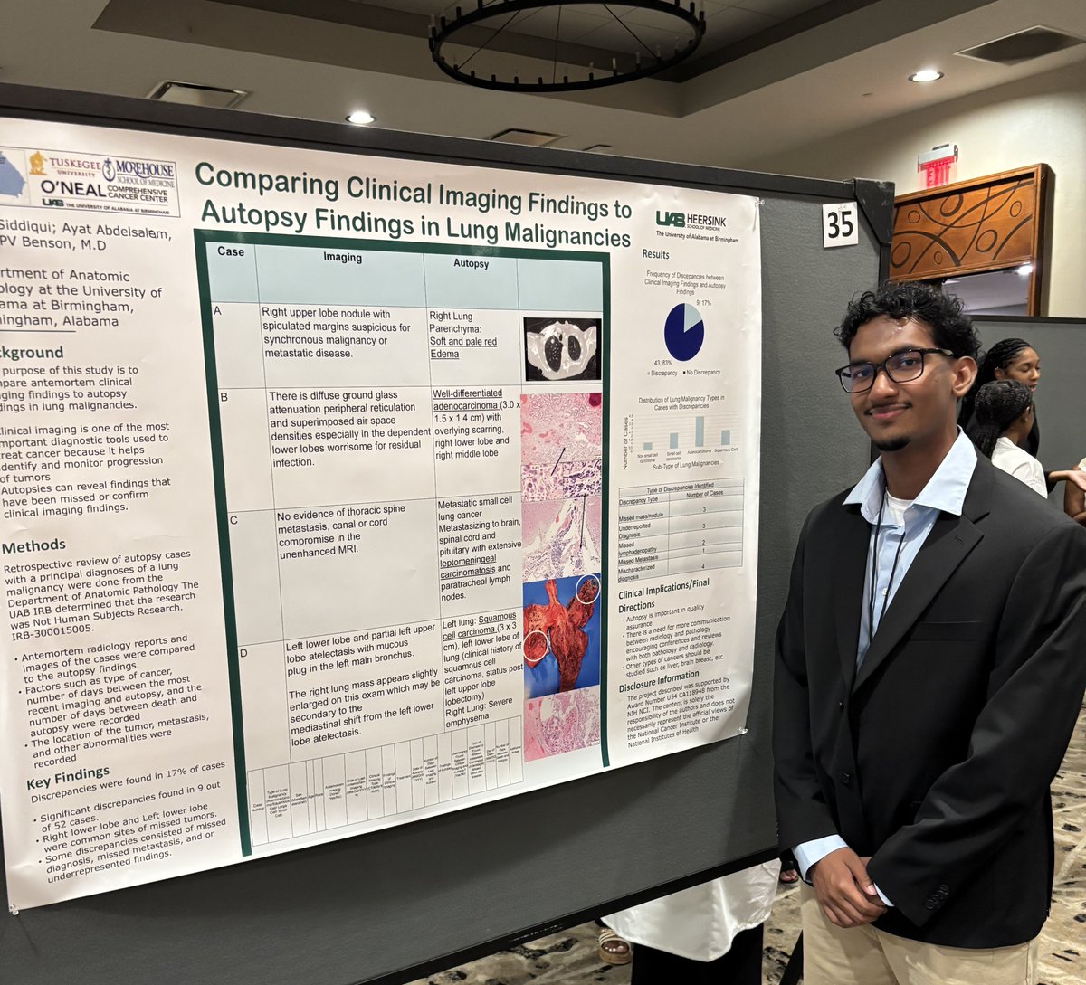 UABPathology's tweet image. Mahi Siddiqui, mentored by Dr. Paul Benson, presented "Comparing Clinical Imaging Findings to Autopsy Findings in Lung Malignancies" at the Cancer Research Symposium at Morehouse School of Medicine in Atlanta, receiving 1st place for best poster presentation. Congrats, Mahi!