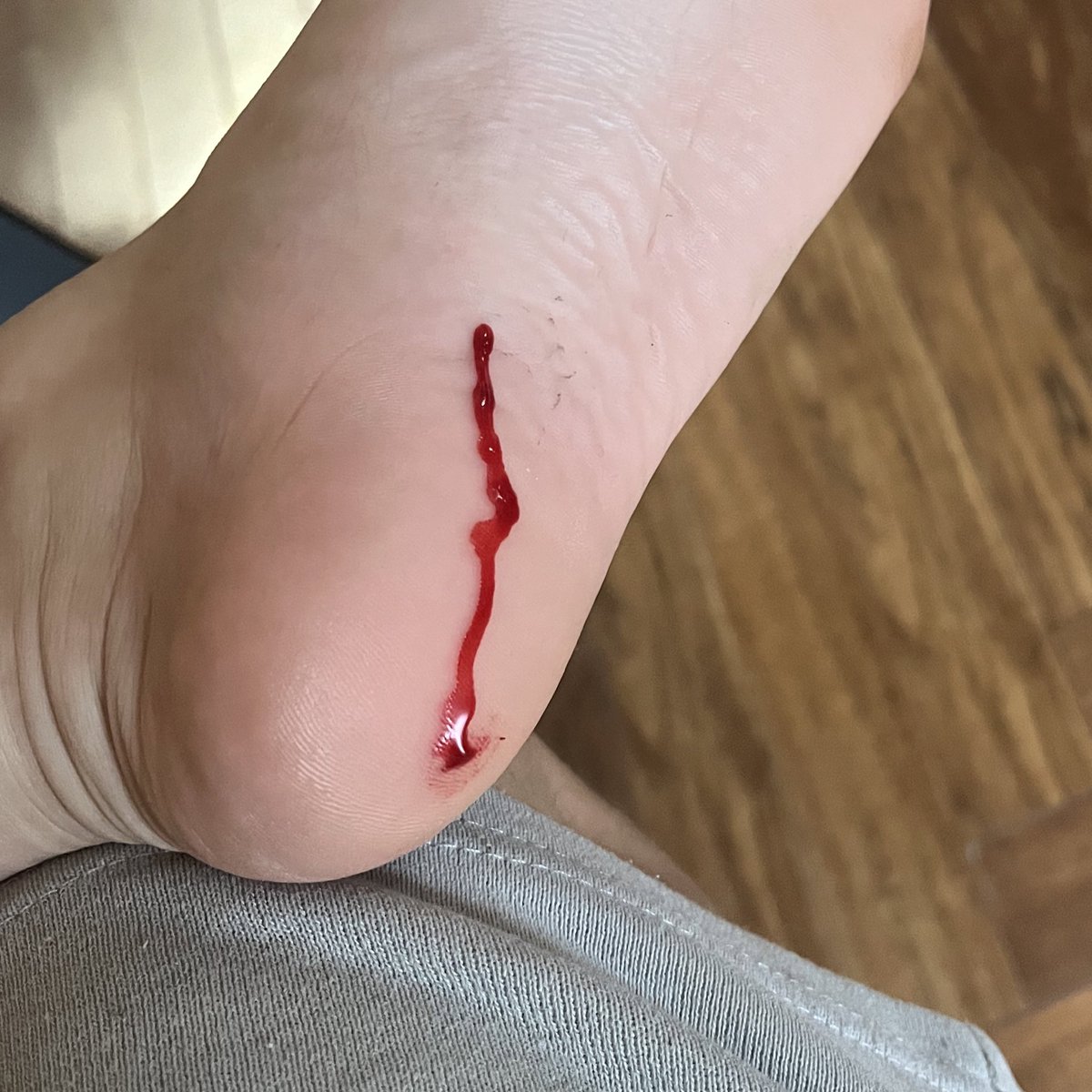 3mptym1ind's tweet image. Tenez ceux qui ont blood kink et/ou feet kink