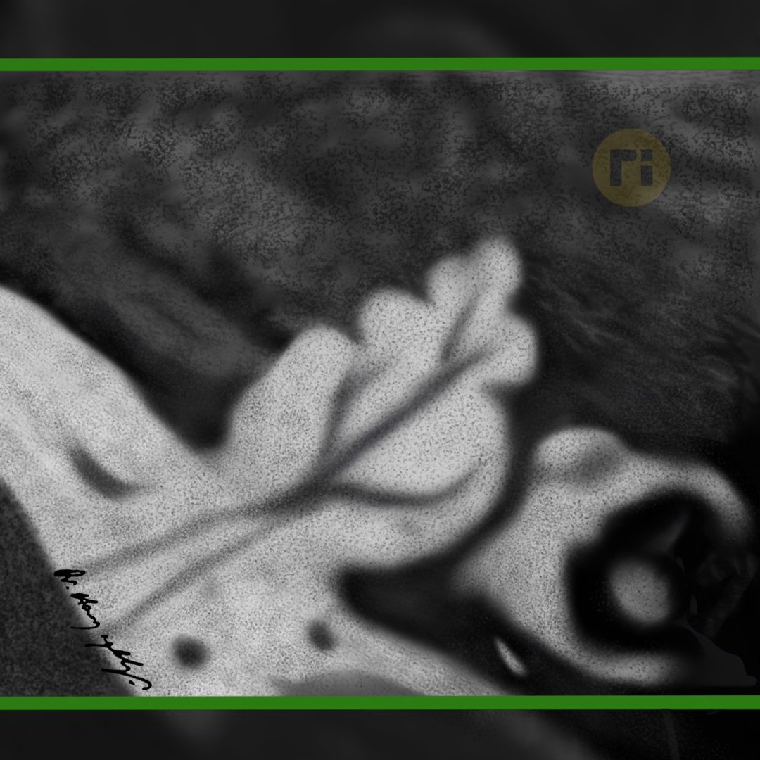 drharunyildiz's tweet image. X‐Linked Deafness DFNX2
(POU3F4 Mutation)
- Dysmorphic Hypothalamus
- Cochlear Incomplete Partition Type III
📌 Corkscrew Appearance
doi.org/10.3390/genes1…
#radiologicalillustration ✍️
pixel by pixel handmade!