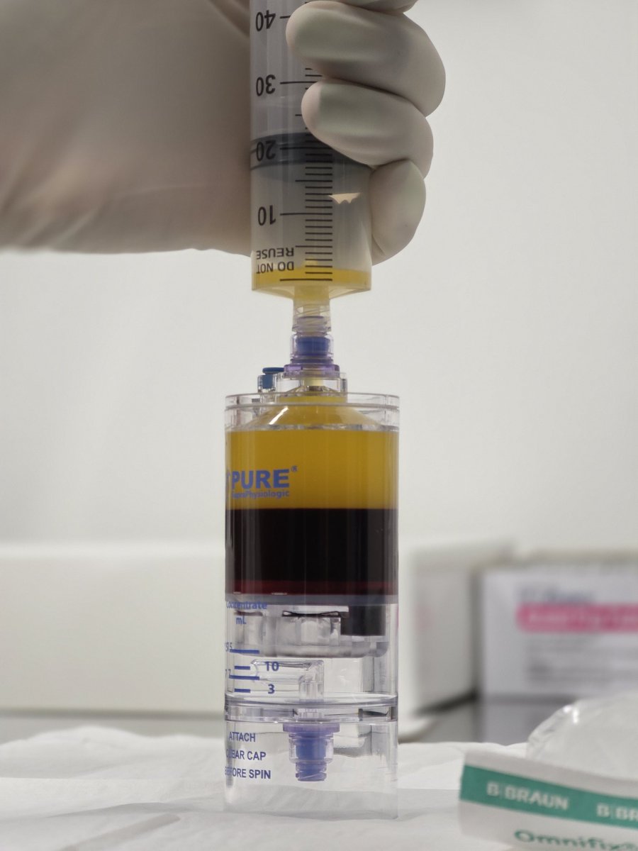 6 year process to get it approved and going. First 4 PRP injections today.

Elbow common extensor tear 
Supraspinatus tear
Anterior talofibular ligament tear 
Patellofemoral osteoarthritis 

#Physiatry #sportsmedicine #regenerativemedicine <a href="/UMiamiHealth/">UMiami Health System</a> <a href="/JacksonHealth/">Jackson Health System</a>