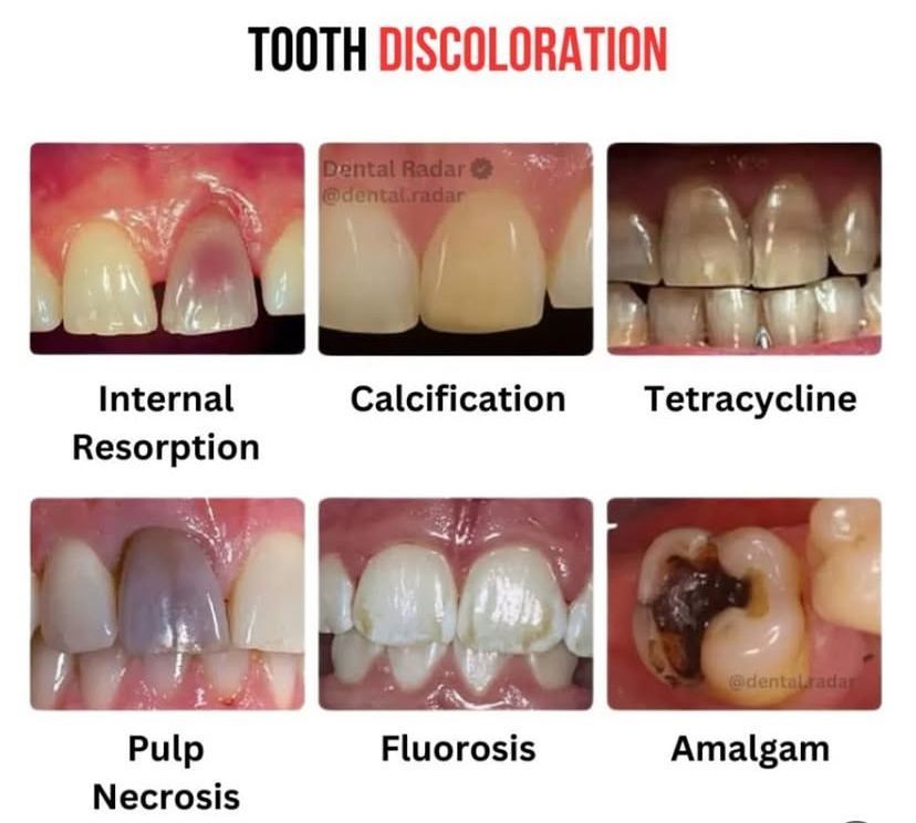 Dr.Doaa🧠🦷🇵🇸 tweet media