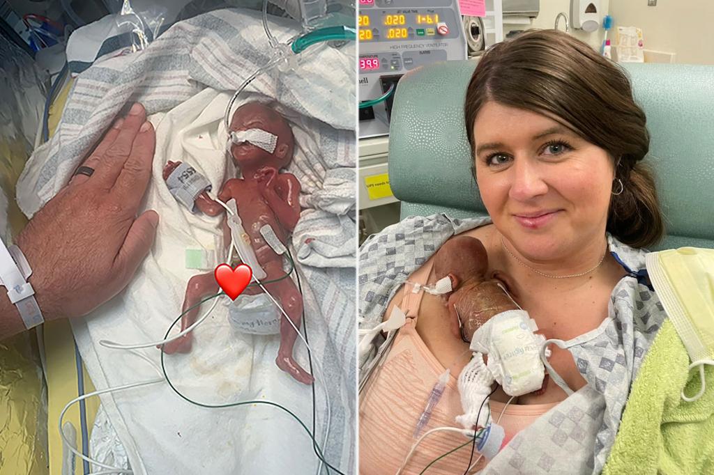This is baby Nash, who just set a World Record as the youngest premature baby ever.

Nash was born at 21 weeks. 

Where's the clump of cells they keep talking about?