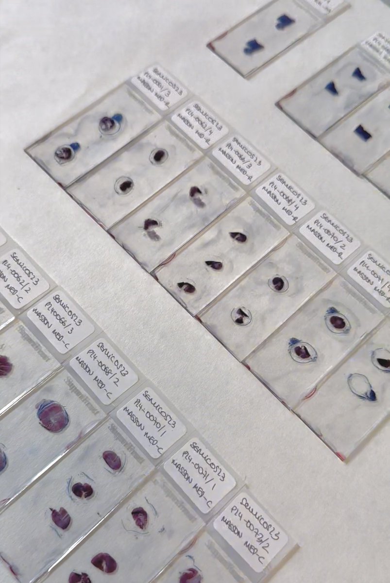 Ester Pérez-Martín (@esterp_m) on Twitter photo La ciencia tiene la magia de devolverte al punto de partida donde todo empezó. El verano de 2015 aprendía tinciones histológicas en el Dpto de Biología Celular (<a href="/usal/">Universidad de Salamanca</a>). Este verano, 10 años después, vuelvo a ese cuaderno de laboratorio para aplicarlas en ensayos preclínicos 👩🏼🔬🔬 La ciencia tiene la magia de devolverte al punto de partida donde todo empezó. El verano de 2015 aprendía tinciones histológicas en el Dpto de Biología Celular (<a href="/usal/">Universidad de Salamanca</a>). Este verano, 10 años después, vuelvo a ese cuaderno de laboratorio para aplicarlas en ensayos preclínicos 👩🏼🔬🔬