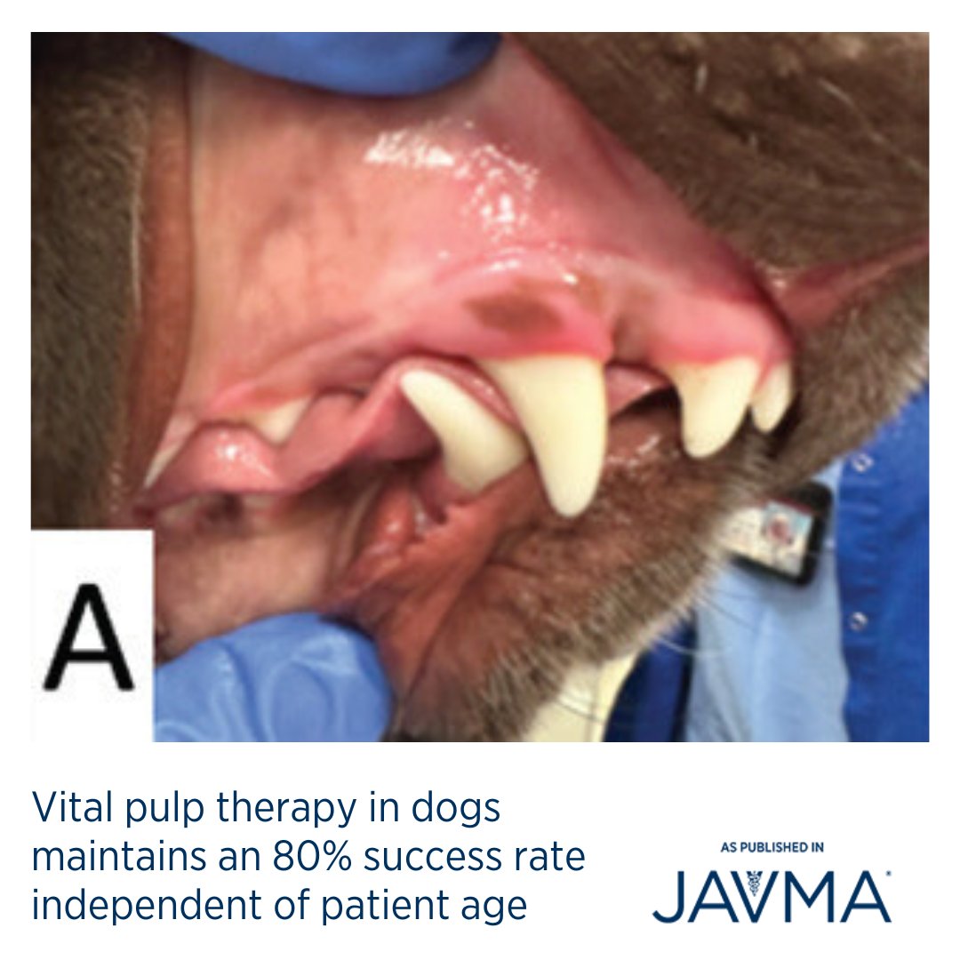 JAVMA (@avmajavma) on Twitter photo Vital pulp therapy remains a viable alternative to root canal therapy for managing pulp exposure in dogs, with an 80% success rate. 🦷🐕 Open access article: jav.ma/vpt <a href="/uwvetmed/">UW School of Vet Med</a> #vitalpulptherapy #VPT #endodontics #pulpexposure #pulpotomy Vital pulp therapy remains a viable alternative to root canal therapy for managing pulp exposure in dogs, with an 80% success rate. 🦷🐕 Open access article: jav.ma/vpt <a href="/uwvetmed/">UW School of Vet Med</a> #vitalpulptherapy #VPT #endodontics #pulpexposure #pulpotomy