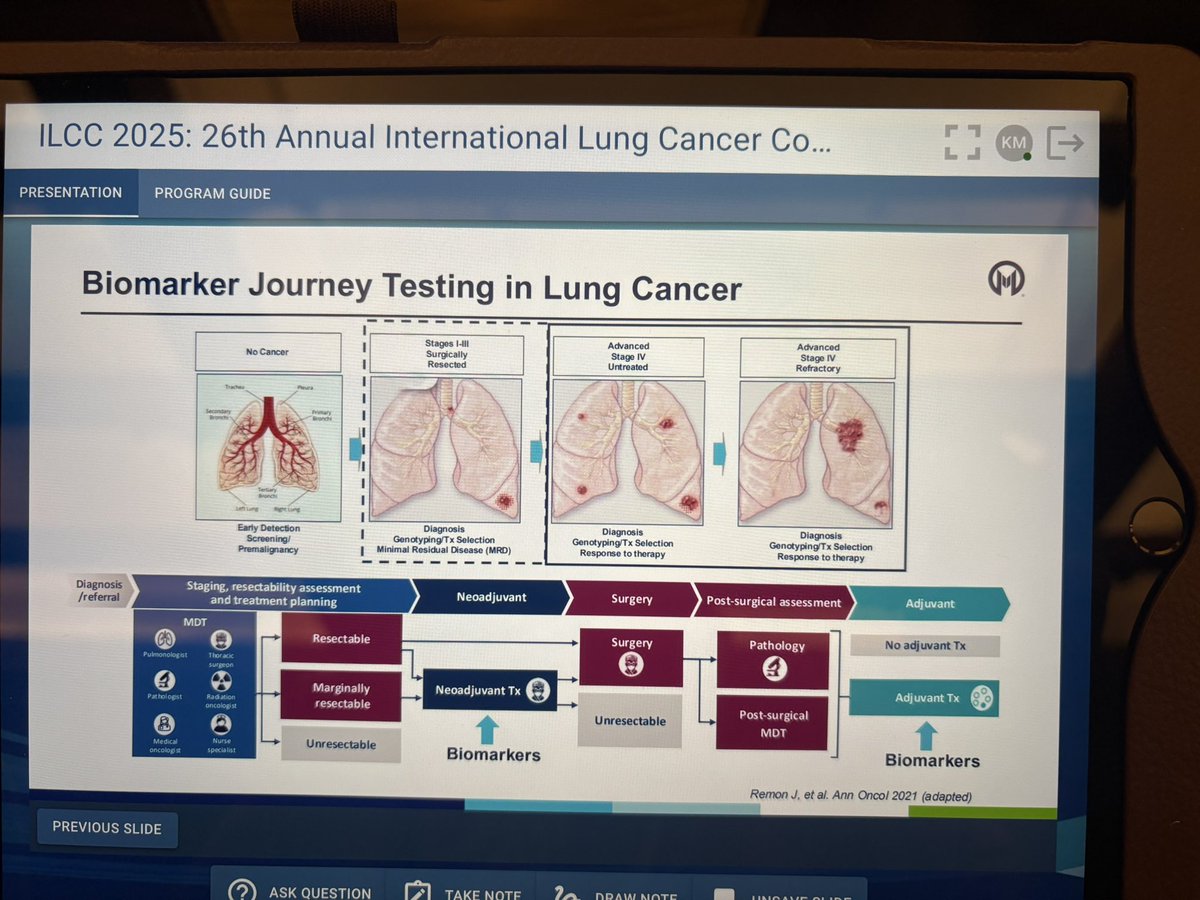 Kelly Mercier, Ph.D (@kellymercierph1) on Twitter photo In the early or locally advanced #NSCLC, we can use liquid phase of FNA or cytology smears to get answers quickly via #pcr prior to treatment decisions. <a href="/MdWistuba/">Ignacio Wistuba, MD</a> #ilcc2025 In the early or locally advanced #NSCLC, we can use liquid phase of FNA or cytology smears to get answers quickly via #pcr prior to treatment decisions. <a href="/MdWistuba/">Ignacio Wistuba, MD</a> #ilcc2025