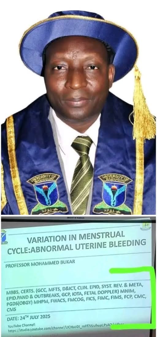 ArewaFactsZone's tweet image. Meet Professor Mohammed Bukar, MBBS, CERTS. (GCC, MFTS, D&ICT, CLIN. EPID, SYST. REV. & META, EPID.PAND & OUTBREAKS, GCP, IOTA, FETAL DOPPLER) MNIM, PGDS(OBGY) MHPM, FWACS, FMCOG, FICS, FIMC, FIMS, FCP, CMC, CMS.
Meanings:
MBBS - Bachelor of Medicine, Bachelor of Surgery…