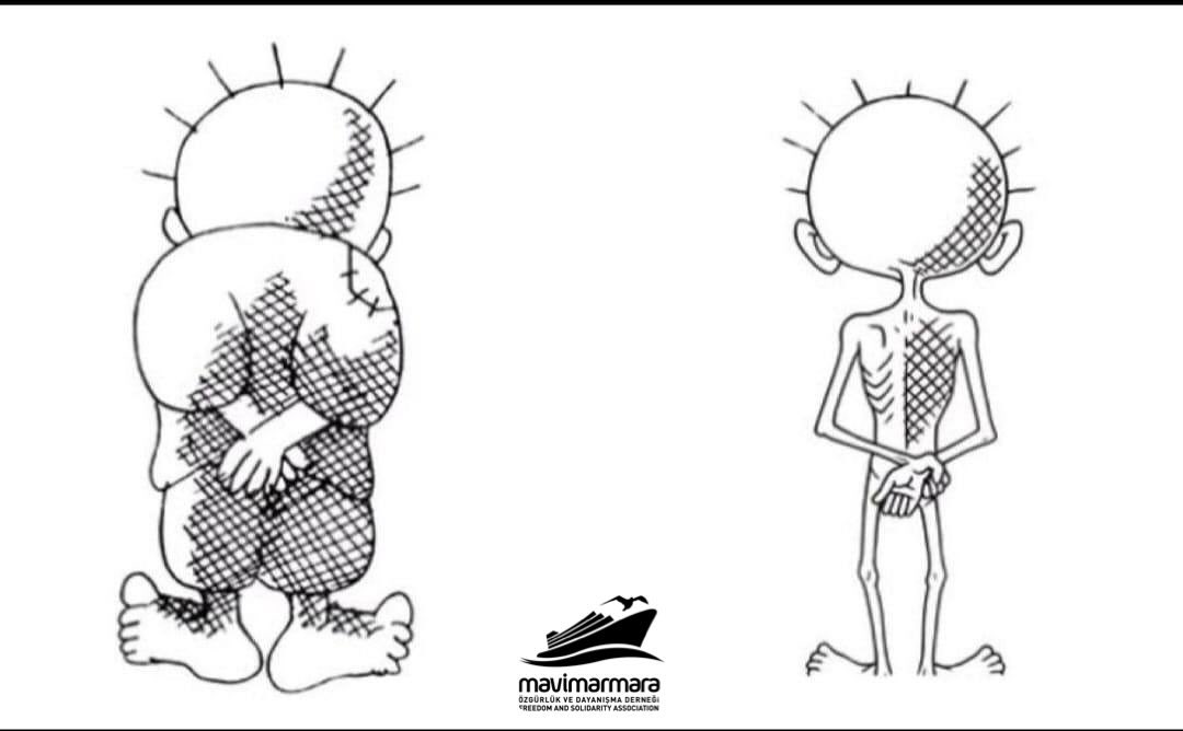 Hanzala açlıktan ölüyor!🇵🇸

Yıllardır suskun dünyaya küs olan Hanzala bitip tükenmek üzere ama dünya devletleri hala suskun!

Paylaş, beğen, destek ol, elinden geleni yap, çünkü Gazze ölüyor!

#hanzala #freepalestine🇵🇸