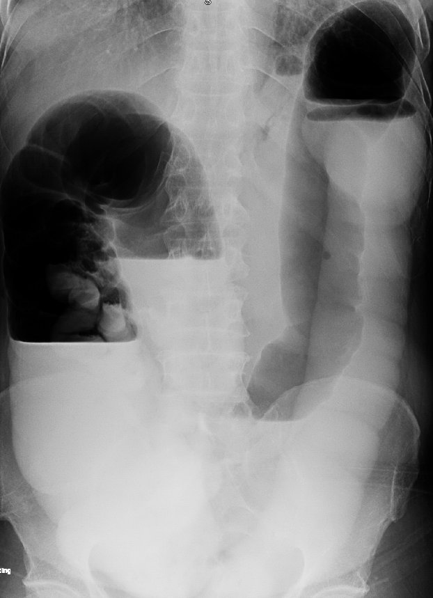 What is the diagnosis?