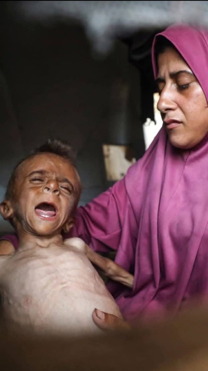 Asmaa5300579616's tweet image. "A child crying out from extreme hunger, and a helpless mother with nothing but her tearsโฆ
Contribute, even a little โ your giving could mean life for them."
#DonateNow #SaveTheChildren
chuffed.org/project/139087