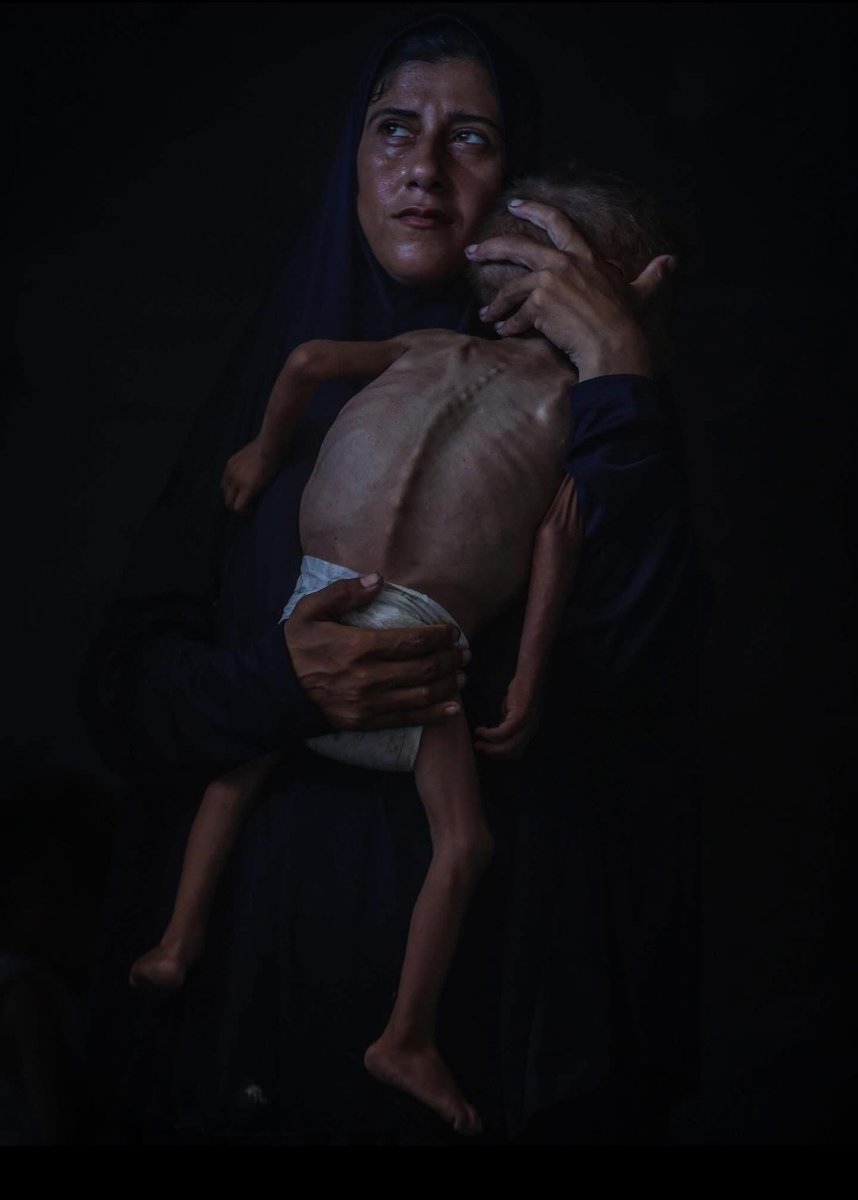 "Obza!"🧵
Ezz Aldin, è nato a Gaza la notte di Natale del 2023, ogni mattina si sveglia, guarda la madre e dice: "Obza! Obza!", vorrebbe dire "Khobza" (Pezzo di pane).
La madre gli risponde: "Non c'è farina, tesoro. Tuo padre è uscito a cercarla".
Dopo un po' il bambino ripete