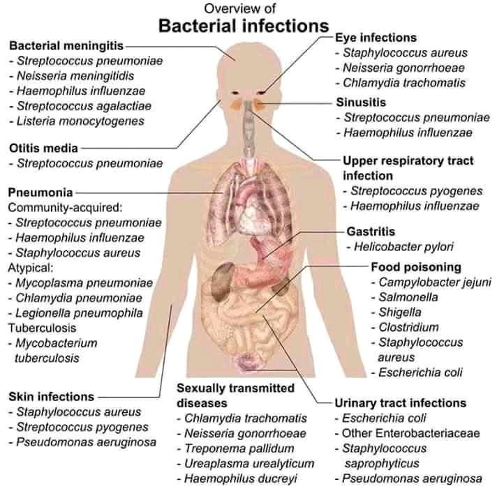 Propharm7's tweet image. ๐ก Bacterial Infections