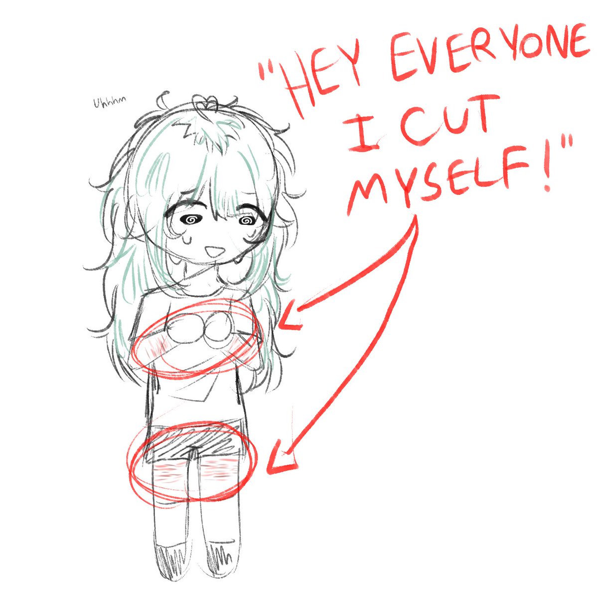 PorceIainCat's tweet photo. how going outside with scars showing feels: https://t.co/DICpRD3DKM