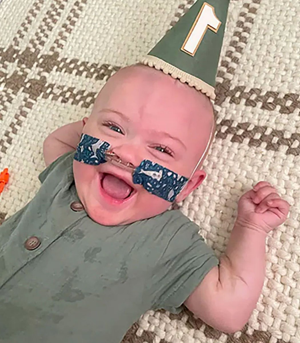A baby born after 21 weeks has become the world’s most premature baby

Nash was born 133 days early and celebrated his first birthday in July to earn the record