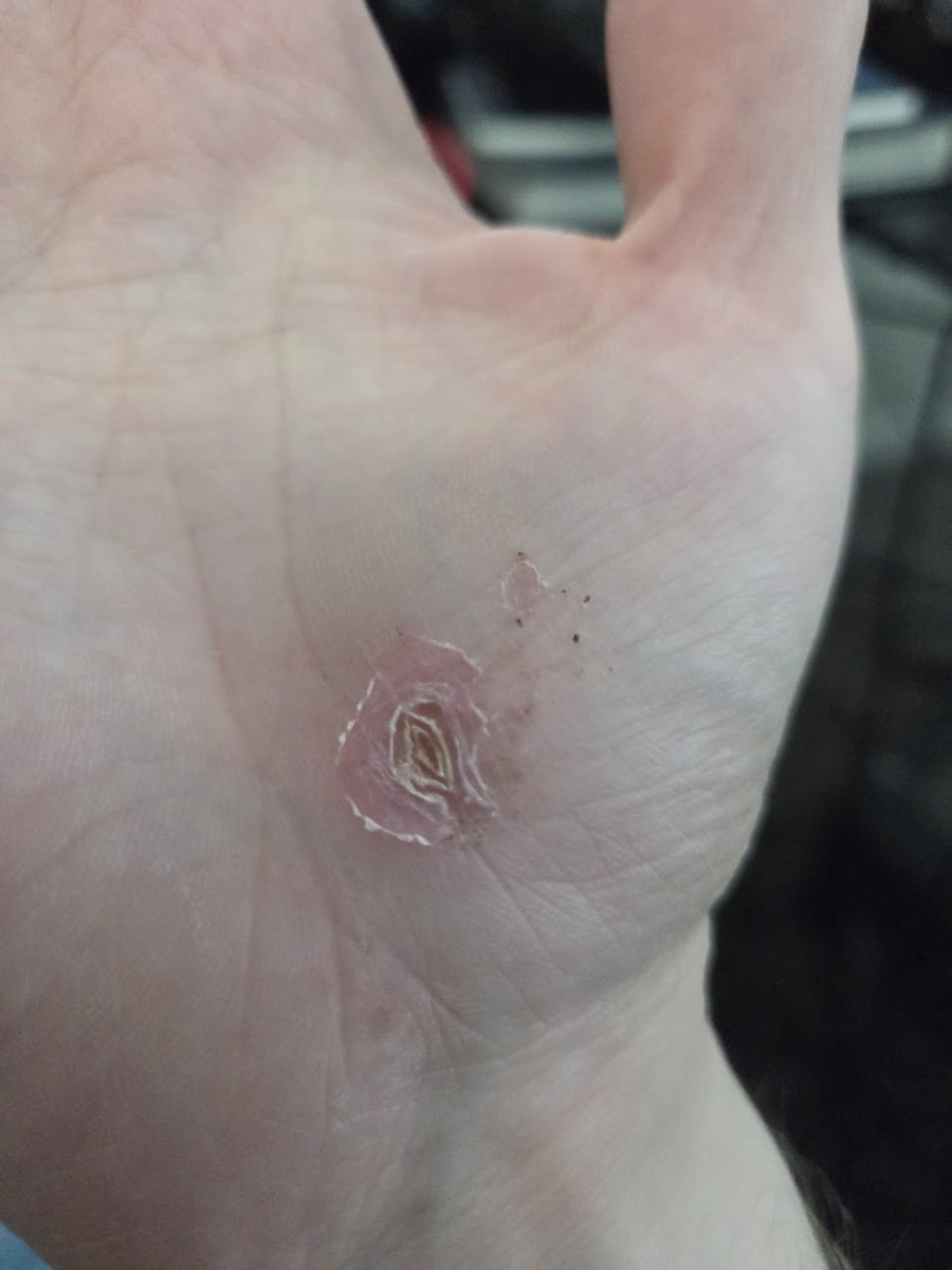 RonTheTryhard's tweet image. Oh no...I&apos;m an onion