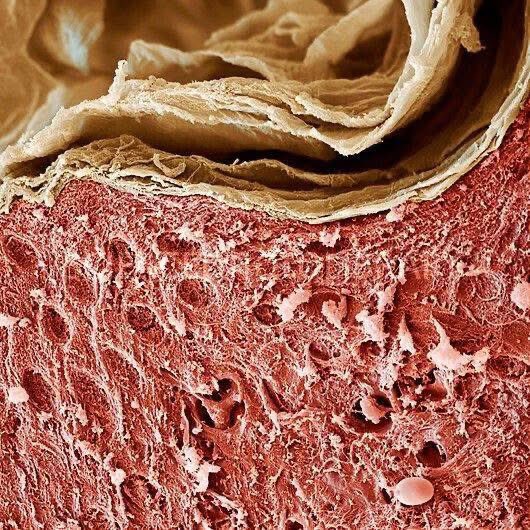 manuelmuro5's tweet image. Piel Muerta, Micrografía Electrónica De Barrido, Microscopio Electrónico, Capas