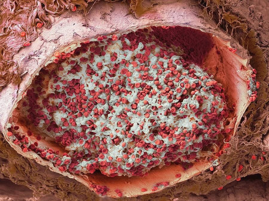 manuelmuro5's tweet image. Coágulo sanguineo en fotografía del pulmón por microscopía Core Facility, Vib Gent