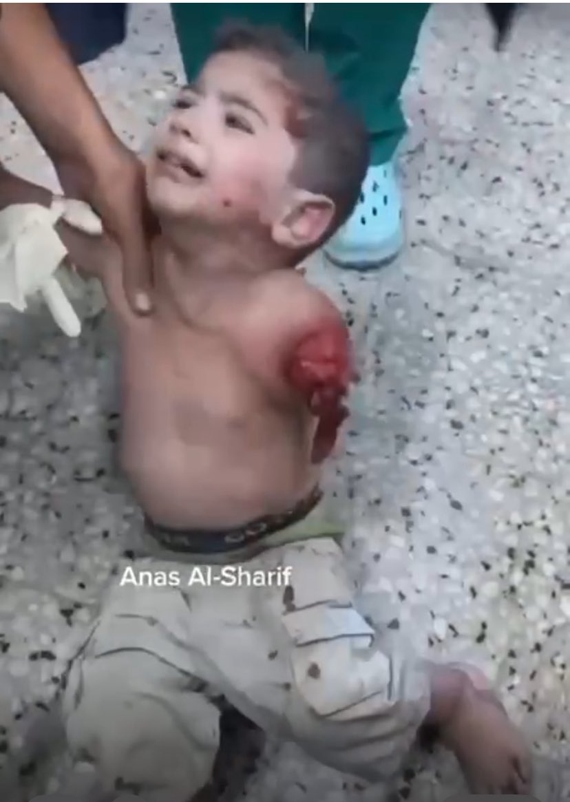 almasry_samer94's tweet image. Today, a school full of displaced civilians was bombed. Some of my relatives were there. I rushed to the hospital to check on them.
I found this child lying in the emergency roomโI stood there, looking at him and crying. What was his fault? Why does he have to live the rest ofโฆ