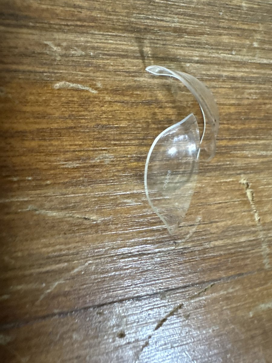 realRPGames's tweet image. Funny turn to the broken scleral lens story. My brain keeps insisting the contact is in, despite the fact I can't see out of the eye. It's like a reverse phantom feeling. The eye isn't missing, just the lens.