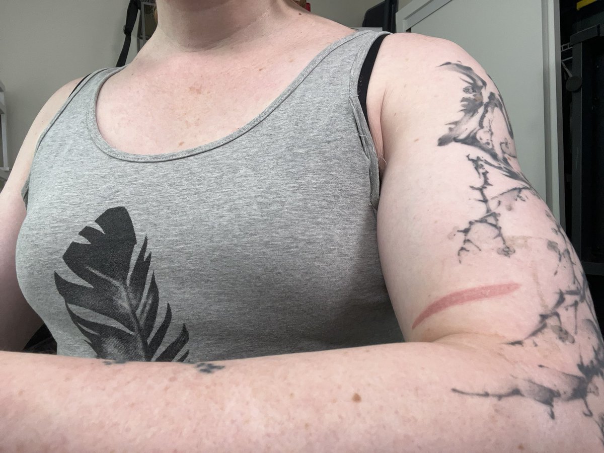 chhopsky's tweet image. burnt my arm on an oven tray a couple days ago. hurt a lot but now that the bandage is off it looks rad as hell

hoping it leaves a scar 🤞 anime ass injury