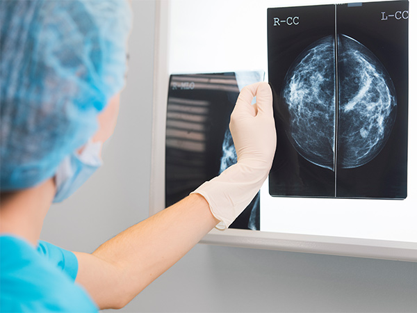 AACRFoundation's tweet image. More than 315,000 people in the United States will be diagnosed with breast cancer this year. Read about prevention, screening, and treatment options for breast cancer. brnw.ch/21wUrbc