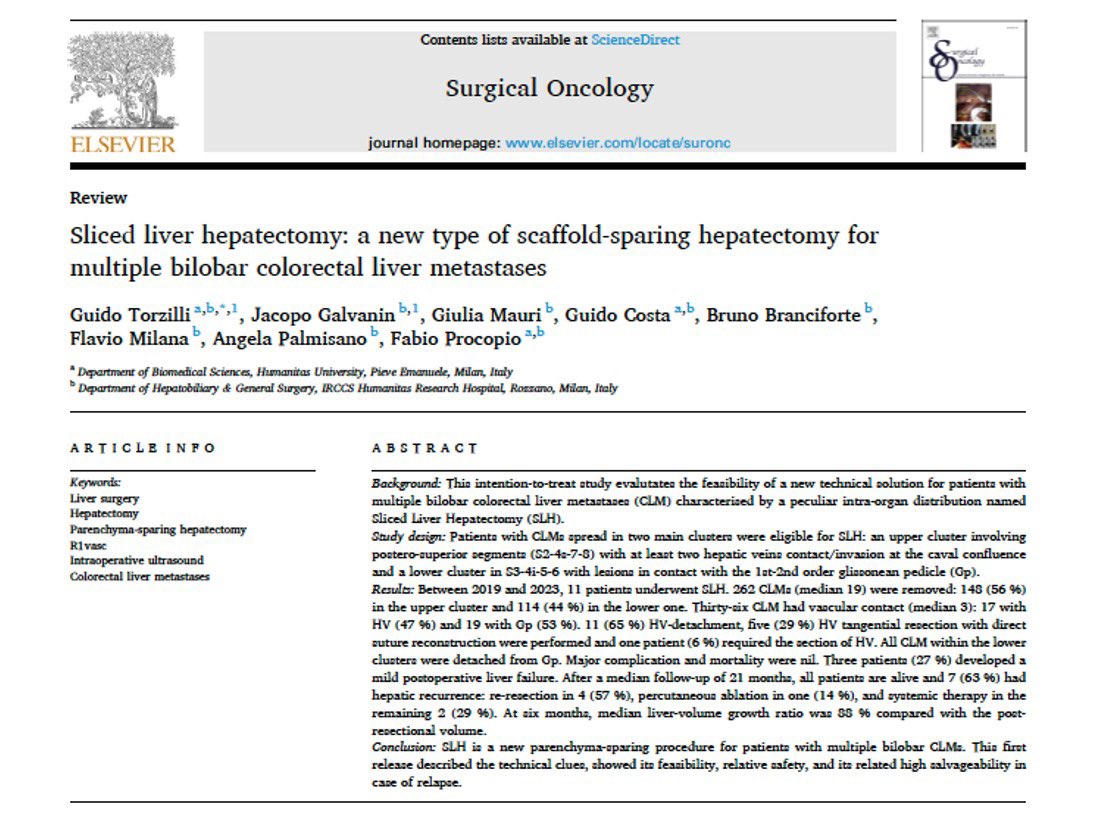 TorzilliGuido's tweet image. Pleased to announce the release of another scaffold sparing solution for boosting one stage removal of multiple bilobar colorectal liver metastases: SLICED LIVER HEPATECTOMY
@HumanitasMilano @HUNIMED
@IHPBA @AHPBA @EAHPBA @APHPBA @IASGO_1988 @SSATNews @SocSurgOnc @Aicep4