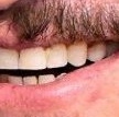 mbirdoss's tweet image. ele esqueceu de escovar os dentes hoje KKKKKK