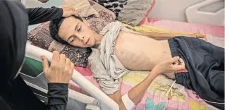 Another day in Gaza and in the heroic IDF’s war on Palestinian children. Here a 17 year old boy weighing just 25 kilos. A pariah state, run by ethnonationalists, religious fanatics and settler extremists, Israel is using its army to enforce a famine. Just like the Warsaw Ghetto.