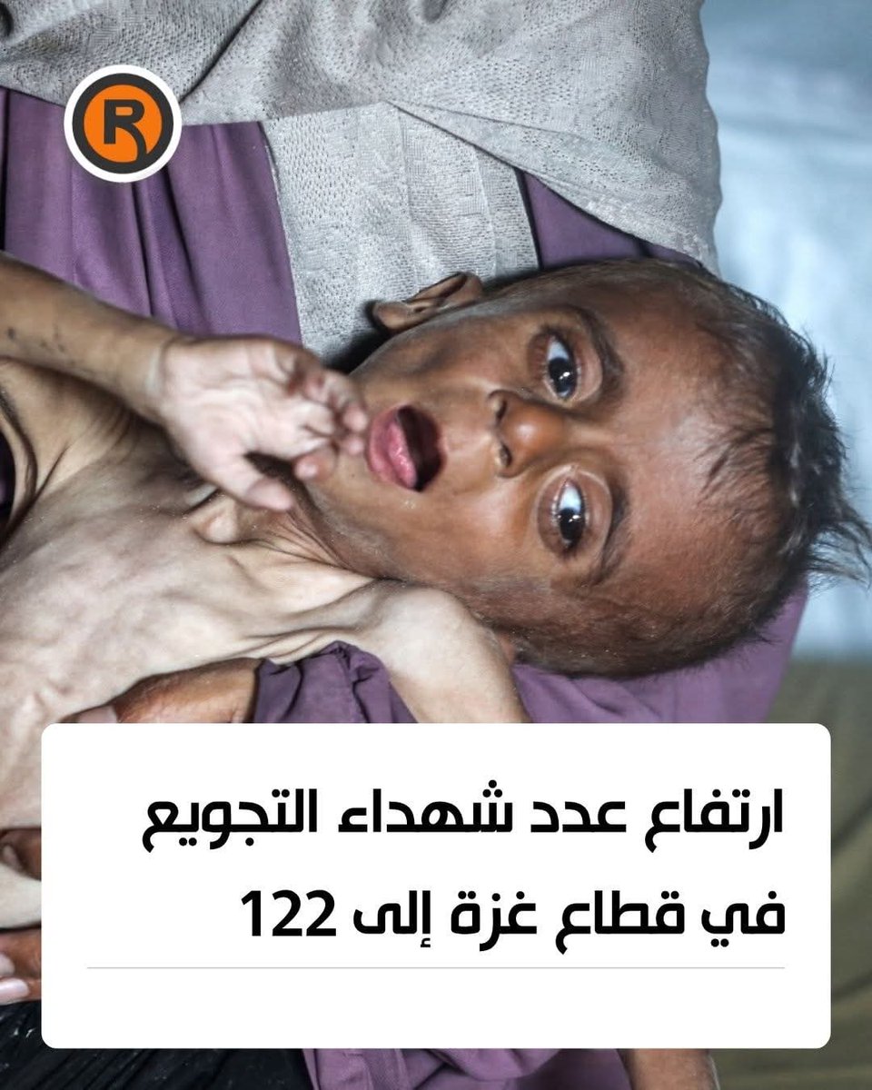 Shimaa_mohmoud1's tweet photo. Every moment, cases of malnutrition and famine are arriving at hospitals, with 900,000 children suffering from hunger, 70,000 of whom have entered the malnutrition stage. https://t.co/33x1A41Mv3