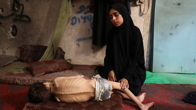 La imagen muestra una escena angustiosa en Gaza, que muestra a un niño desnutrido acostado sobre una colchoneta, que parece demacrado con costillas visibles, mientras una mujer con un hiyab negro se arrodilla a su lado, ofreciéndole atención. El escenario es una habitación improvisada con poca luz con una alfombra gastada, almohadas y paredes cubiertas de graffiti, lo que refleja las terribles condiciones de vida descritas en la publicación. El texto de la publicación de Manu Pineda destaca la descripción de la ONU de los habitantes de Gaza como "cadáveres ambulantes" debido al hambre y al conflicto en curso, enfatizando la crisis humanitaria, la ayuda bloqueada y el presunto genocidio por parte de Israel. No se ven marcas de agua en la plataforma.