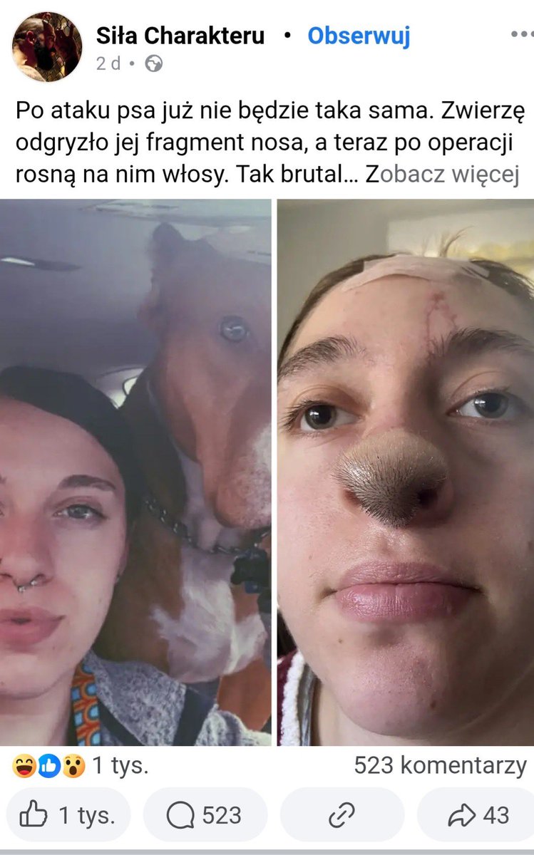 FilipPatek1's tweet image. Dajcie link do zbiórki, chcę pomóc tej dziewczynie