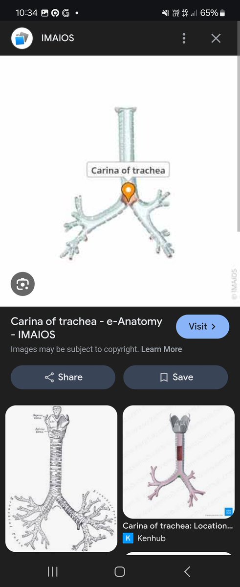 <a href="/tanyakanrl/">Tanyarl 💚</a> Carina, nama bagian dari percabangan trakea dan bronkus. nama "carina" dari latin juga artinya 'kesayangan'. dan jadi poin plus kalau kamu suka aespa (mirip nama leadernya).

aku kasih ini. tapi, jangan pernah kamu sekeluarga maksa dia jadi nakes kalau dia memang gak mau ya.