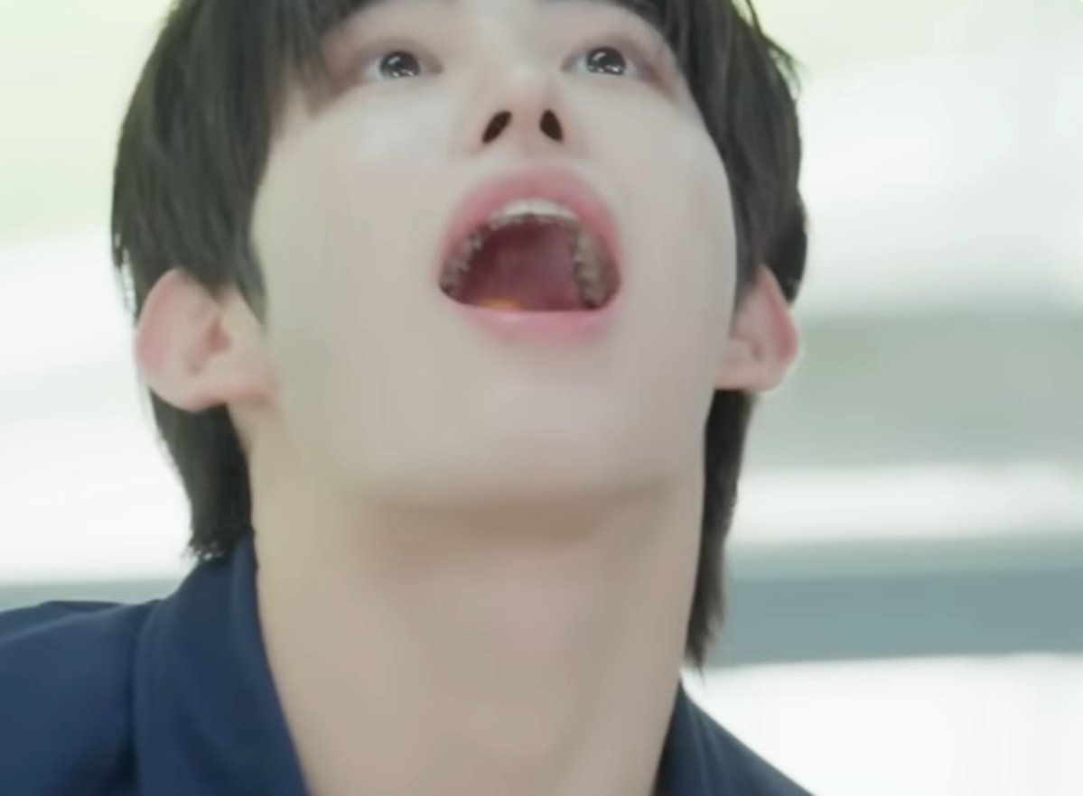 ntrvp6's tweet image. i was watching the new kfp video and i noticed a bunch of black stuff on minjes teeth so i thought he had a bunch of cavities, but doesnt this look like braces?